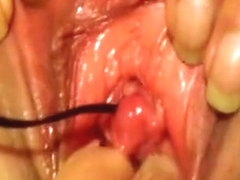 Vibrating Egg in pee hole