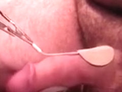 First recorded HFO using homemade E-Stim