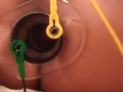 Electro plug pulsates into subs gap, giant comshot