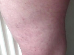 Foreskin with 2 casino chips and 1 table tennis ball