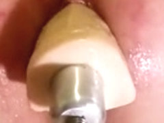 Over penetrated pt 1