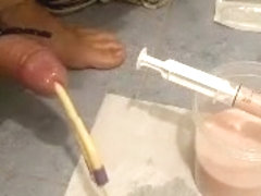 500cc of yogurt in my bladder