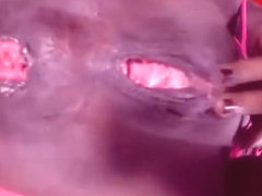 Ebony Anal prolapse 1