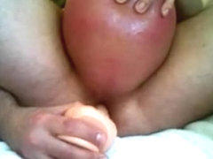 Saline Infusion ~ 8 May 2009 #2