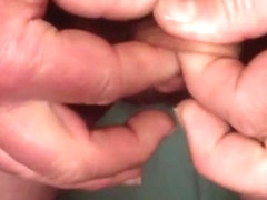 Foreskin with two 9v batteries