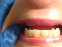 Gloved Mouth Exam