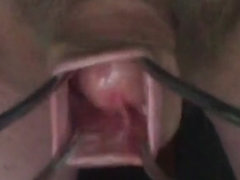 20-minute foreskin video jizz