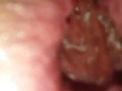 Anal gaping close up