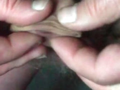 Foreskin with seven batteries (2 9V + 5 AAA)