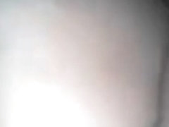 Worthwhile Birthmark & Arse