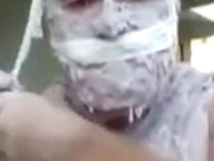 encased in plaster and rubber